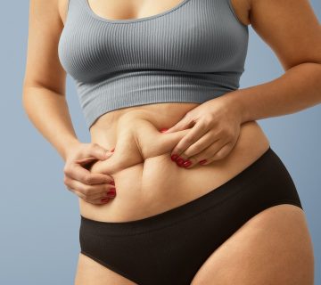 donna dimagrimento localizzato | Nutrizionista Messina
