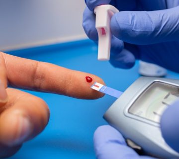 analisi rischio cardiovascolare e gestione diabete tipo 2 | Nutrizionista Messina